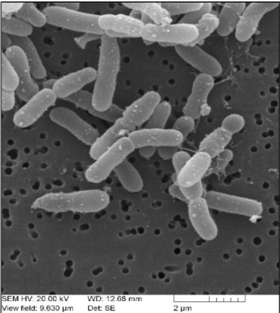 anaerobni-mikrobiologie-1